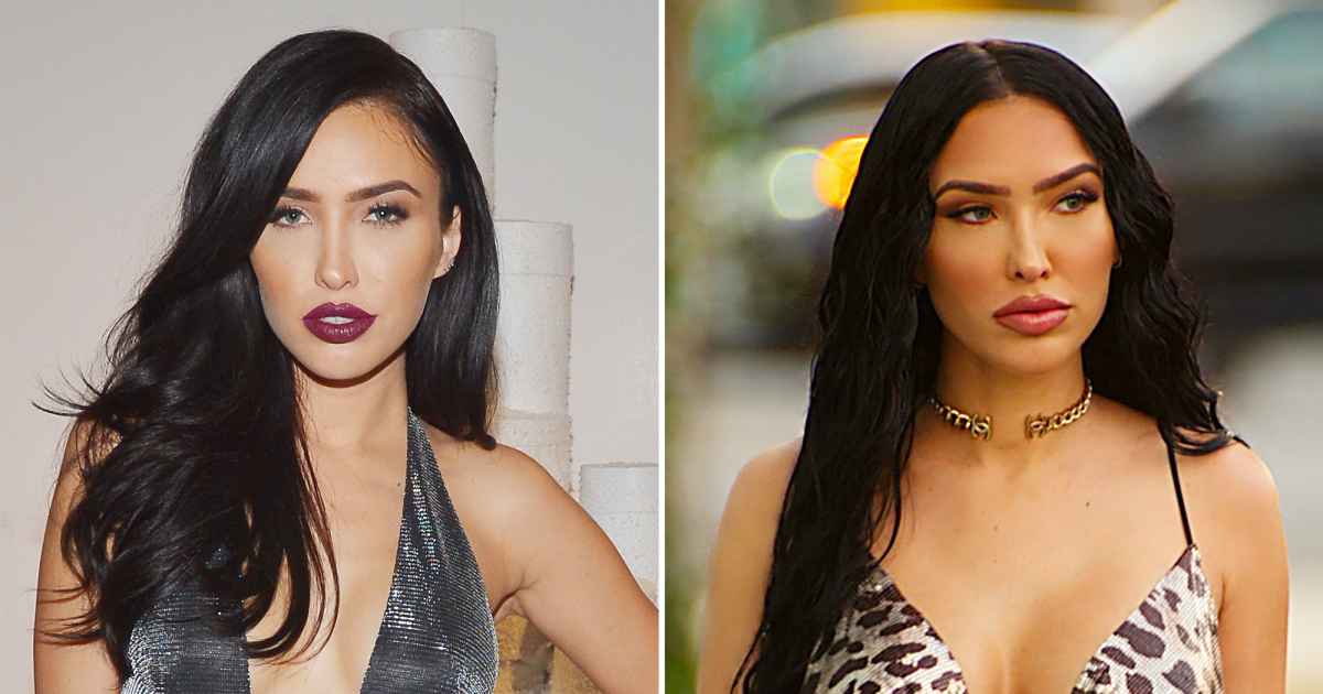 ‘Selling Sunset’ Stars: How They’ve Changed Over the Years – A Look at Their Before & After Photos