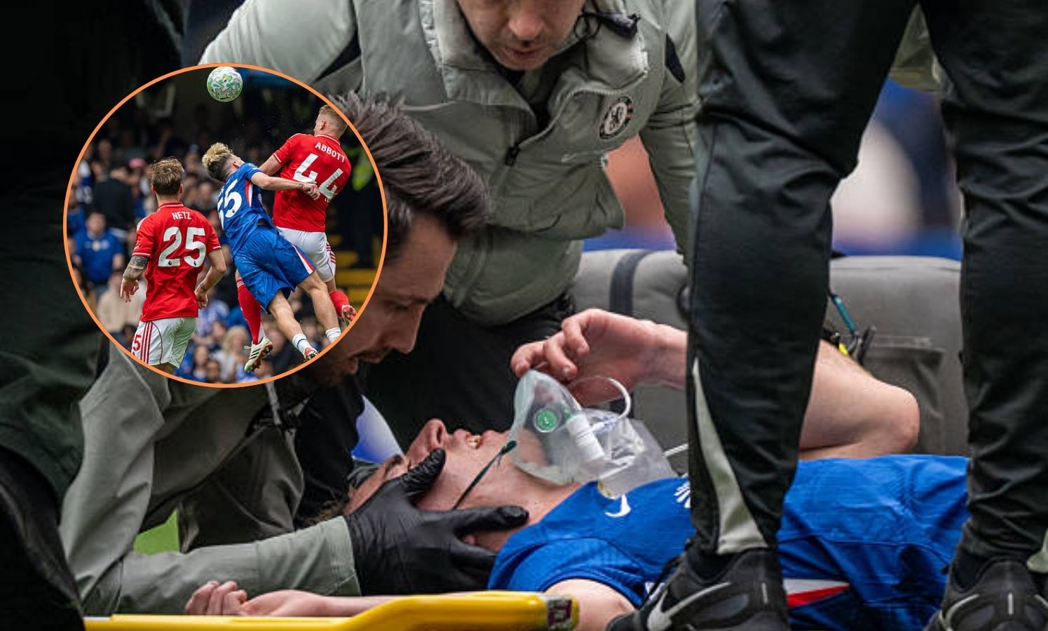 Watch: Jesse Derry suffers horror injury and is stretchered off on debut for Chelsea vs Nottingham Forest